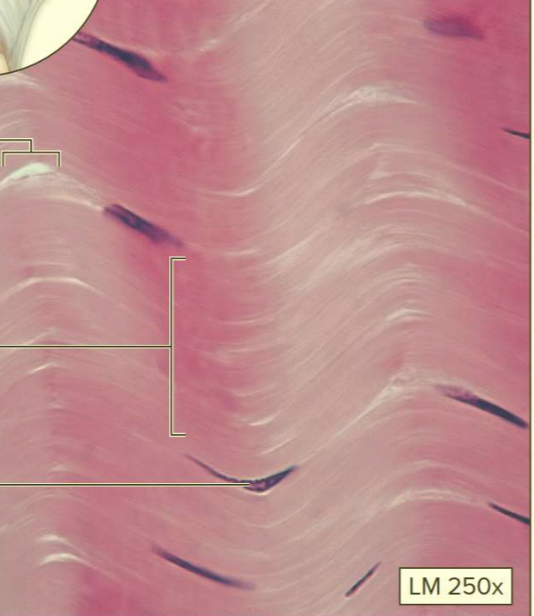 <p>What type of tissue?</p>