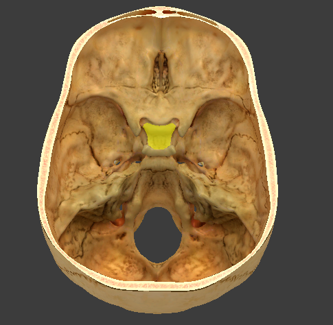 term image