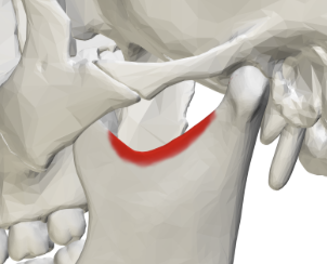 <p>A V like depression in the margin or edge of a flat area</p>