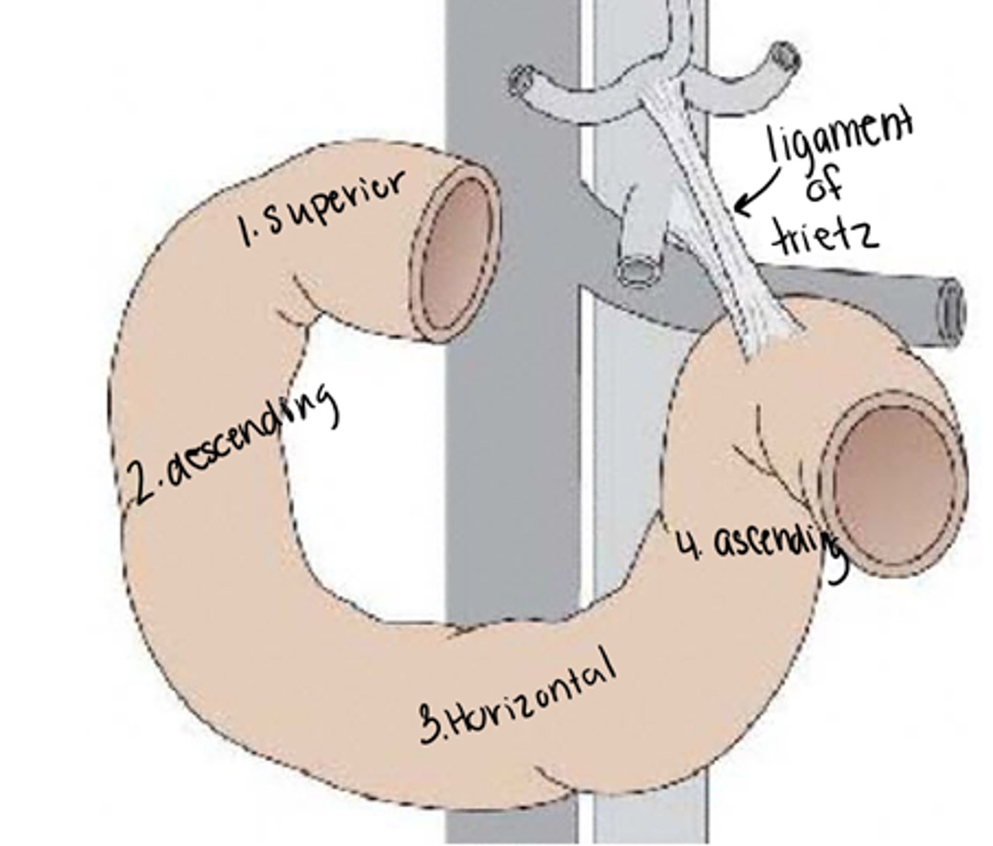 <p>Ligament found at the transition from duodenum to jejunum (suspensory ligament)</p>