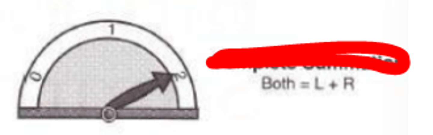 <p>degree of binocular summation where the binocular performance is equal to the sum of monocular performance. Is relatively rare. Ie) VA does not improve 2x with both eyes open</p>