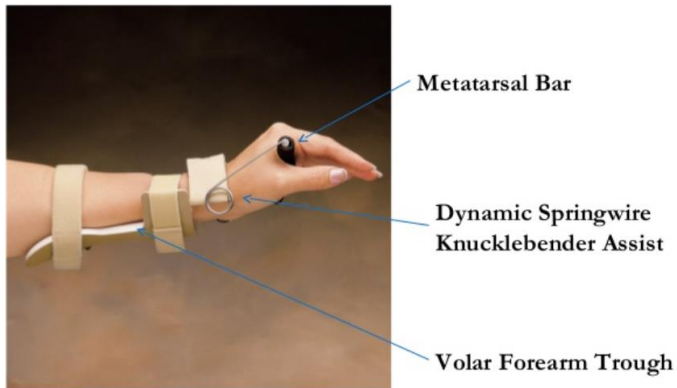 <p>What is the use of a dynamic wrist extension splint?</p>