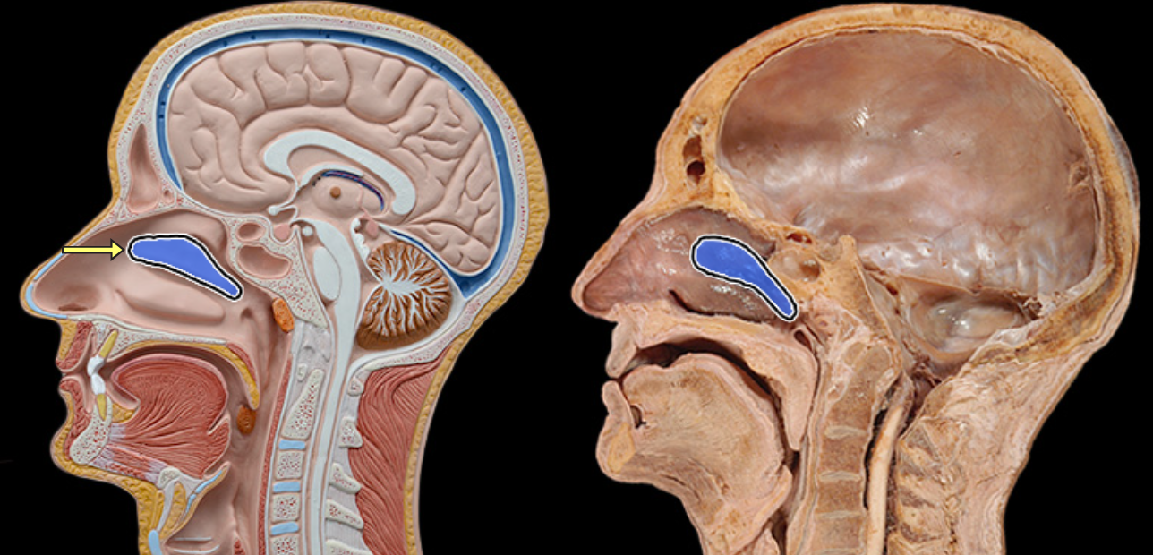 <p>Middle nasal concha</p>