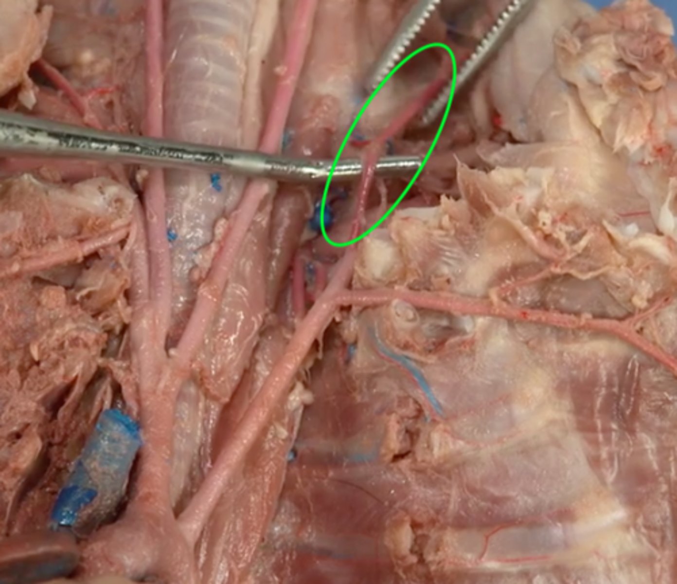 <p>4th branch of the subclavian artery; supplies neck</p>