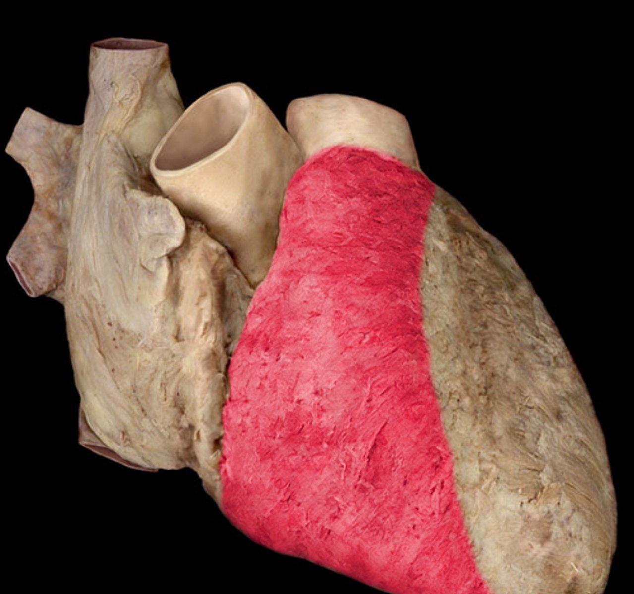 <p>majority of heart we see in situ</p>
