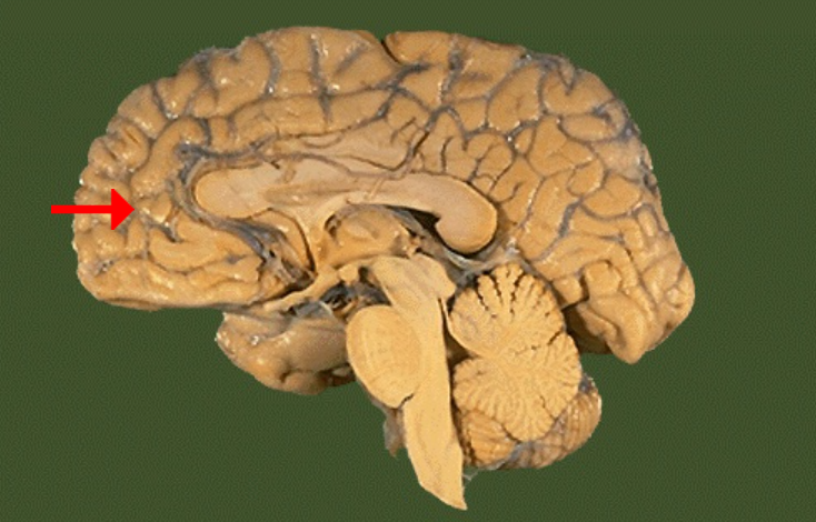 <p>Label this brain part</p>