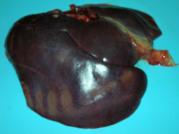 <p>is this a real lesion or not**</p>