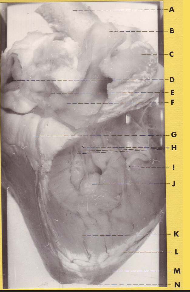 <p>E </p><p>(Sheep Heart with RA &amp; RV Partially Removed)</p>