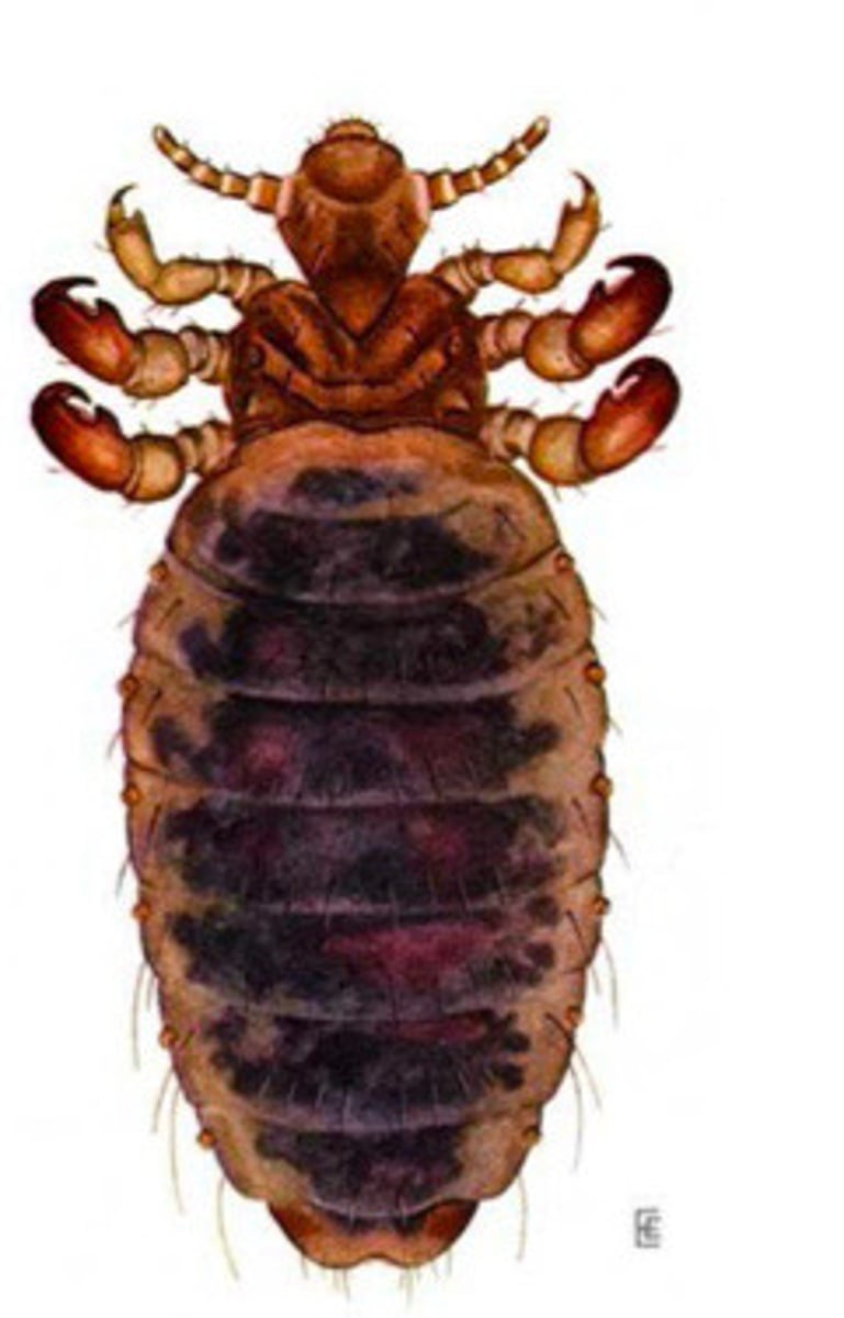 <p>What type of lice is this?</p>