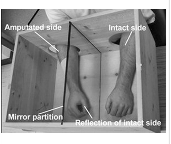 <p>shows how important vision is!</p><ul><li><p>patient sits with a mirror in between so healthy limb is reflected in the mirror</p></li><li><p>moves healthy limb while looking at the mirror</p></li><li><p>brain is tricked into thinking amputated limb is moving normally too</p></li></ul><p></p>