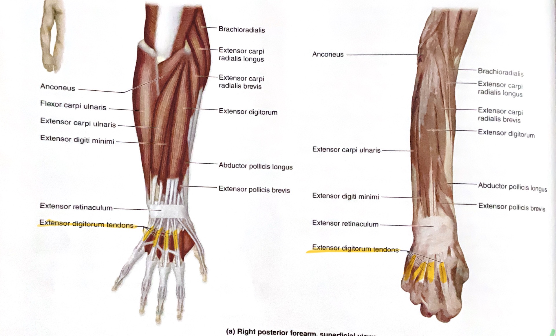 <p>Action: Extend fingers </p>