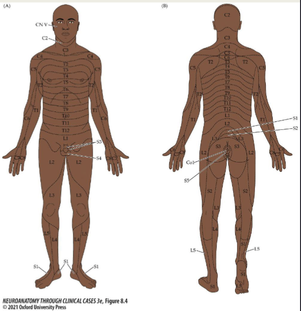 <p>sensory region of skin innervated by a nerve root</p><p>– Useful for clinically isolating lesions</p>