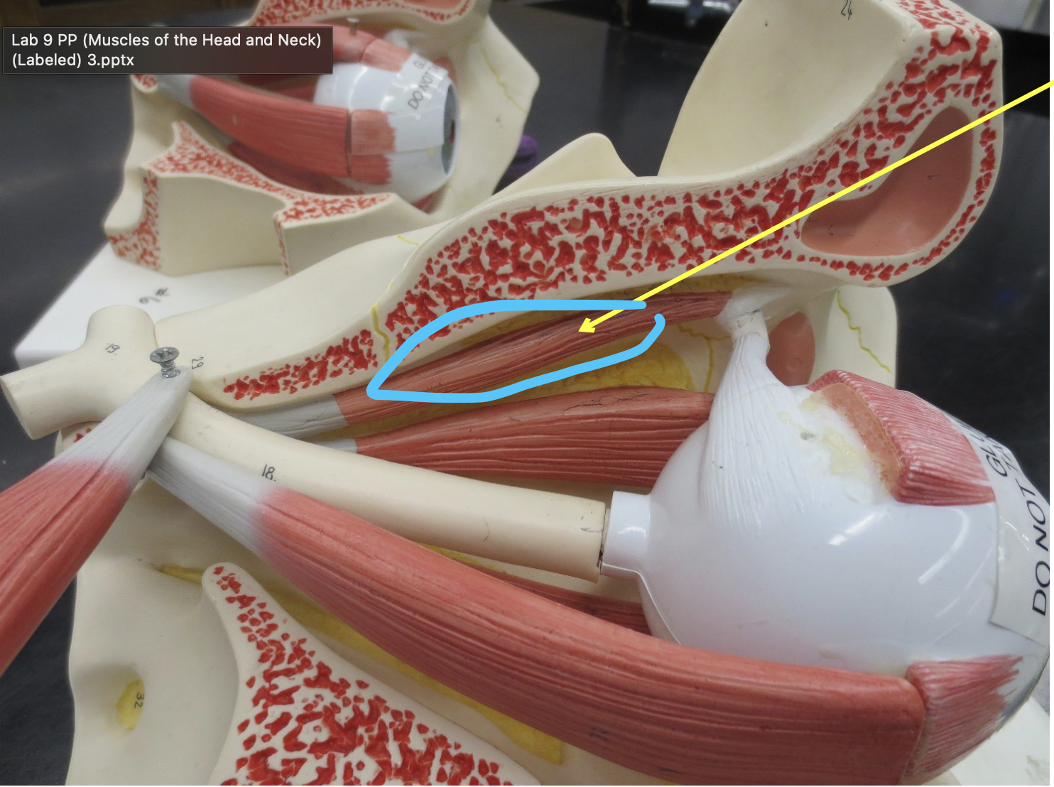 <p>Which muscle</p>