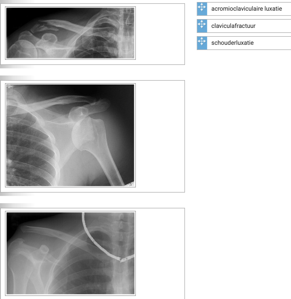 Welke diagnose hoort bij welke foto?