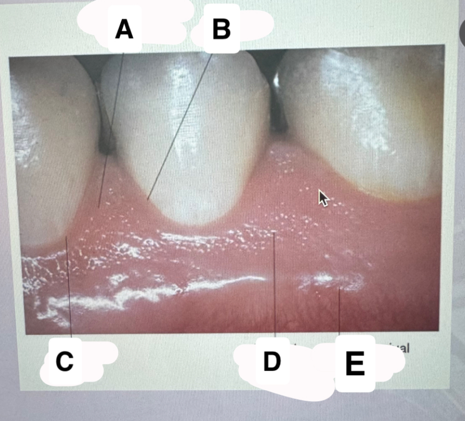<p>Identify D</p>