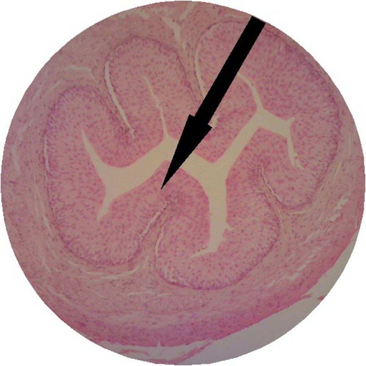 <p>Identify this urinary system structure.</p>
