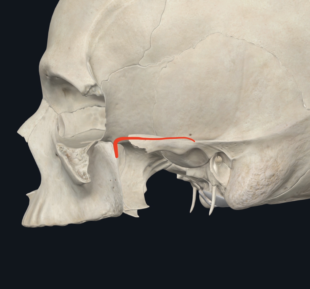 <ul><li><p>Límite superior de la fosa infratemporal o cigomática</p><ul><li><p>Cara inferior del <strong>ala mayor del esfenoides</strong> (desde la base de la apófisis pterigoides HASTA <strong>Cresta temporal del esfenoides</strong>)</p></li><li><p>Cara infratemporal del hueso temporal</p></li></ul></li></ul><p></p>