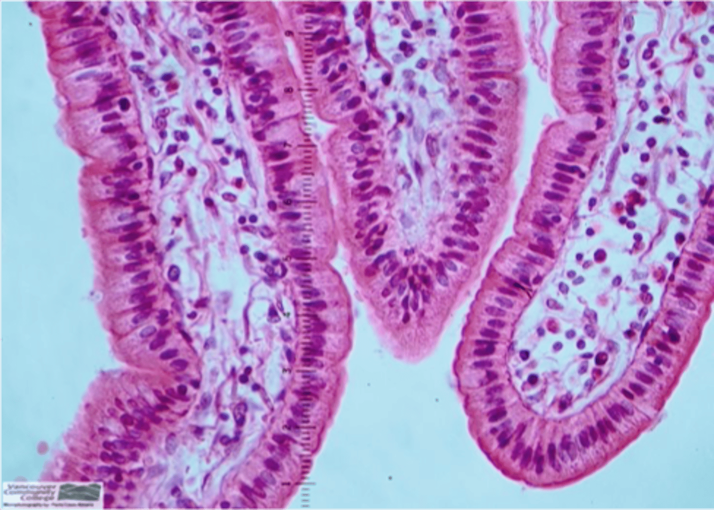 <p>Found in the small intestine.</p>
