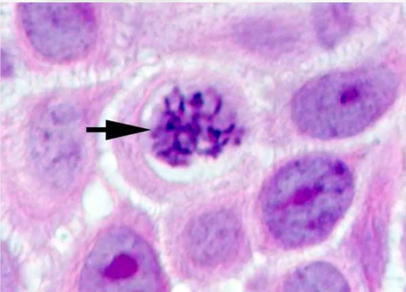 <p>Identify the stage of mitosis</p>