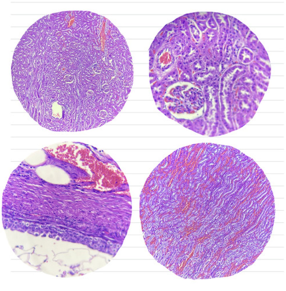 <p>all these slides are what organ?</p>