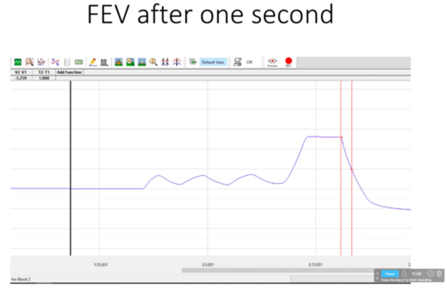 <p>What is the forced expiratory volume after 1 second (FEV1)? This occurs from the start of forced exhalation to one second after</p>