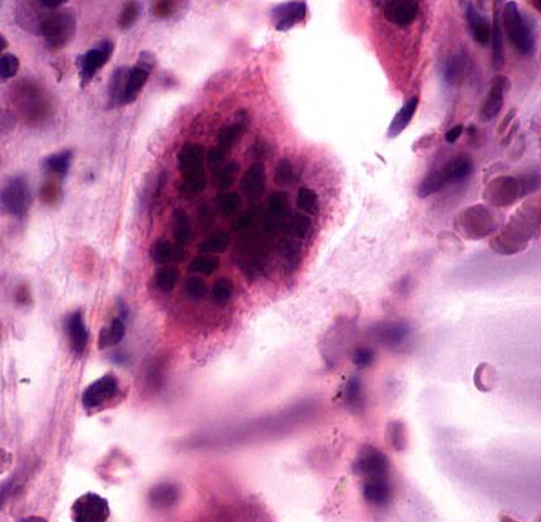 <p>type of cell</p><p>note the large cell size and the many nuclei</p><p>some of these cells have “fuzzy” or “spiky” edges</p>