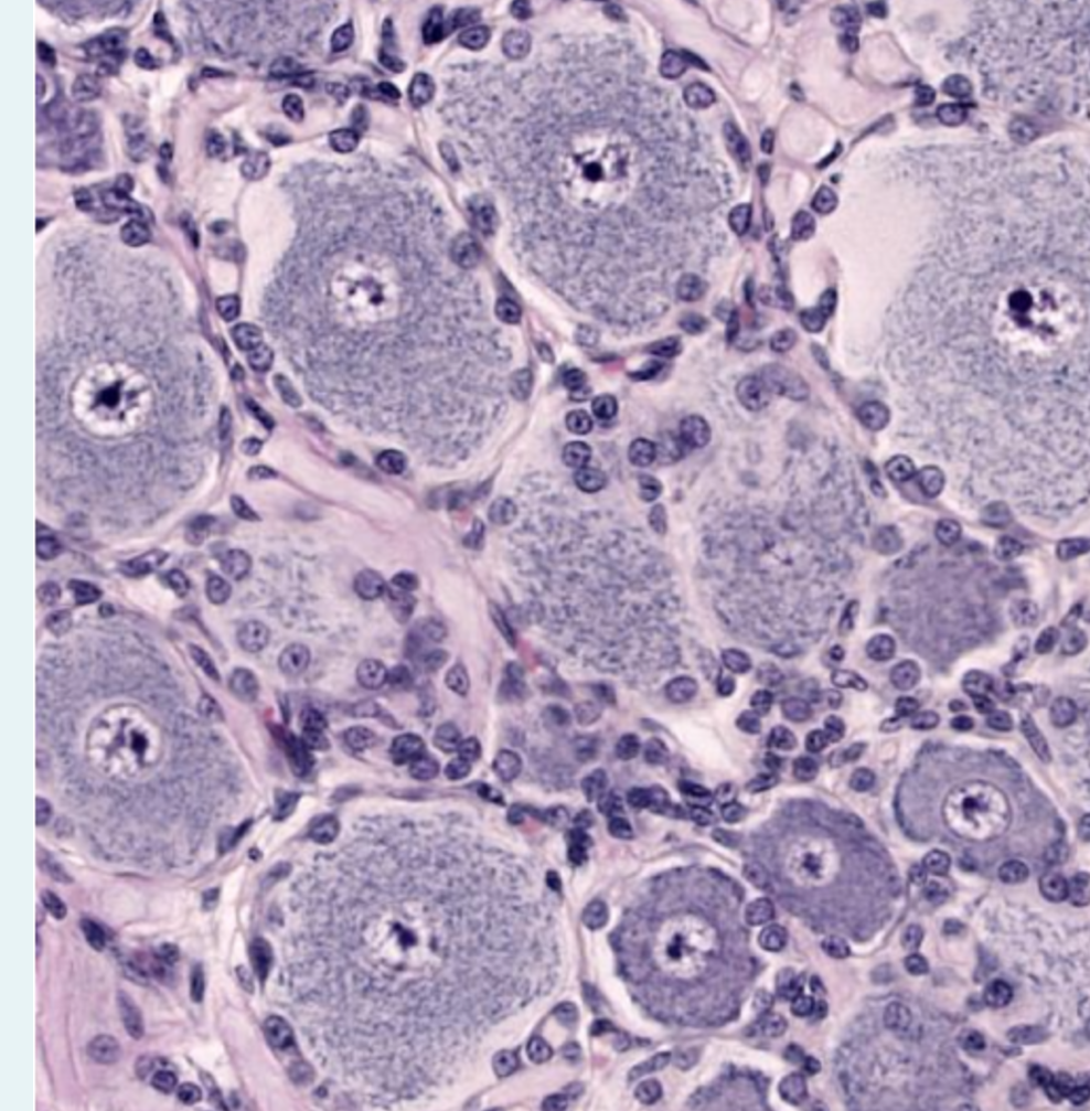 <p>which ganglion</p>