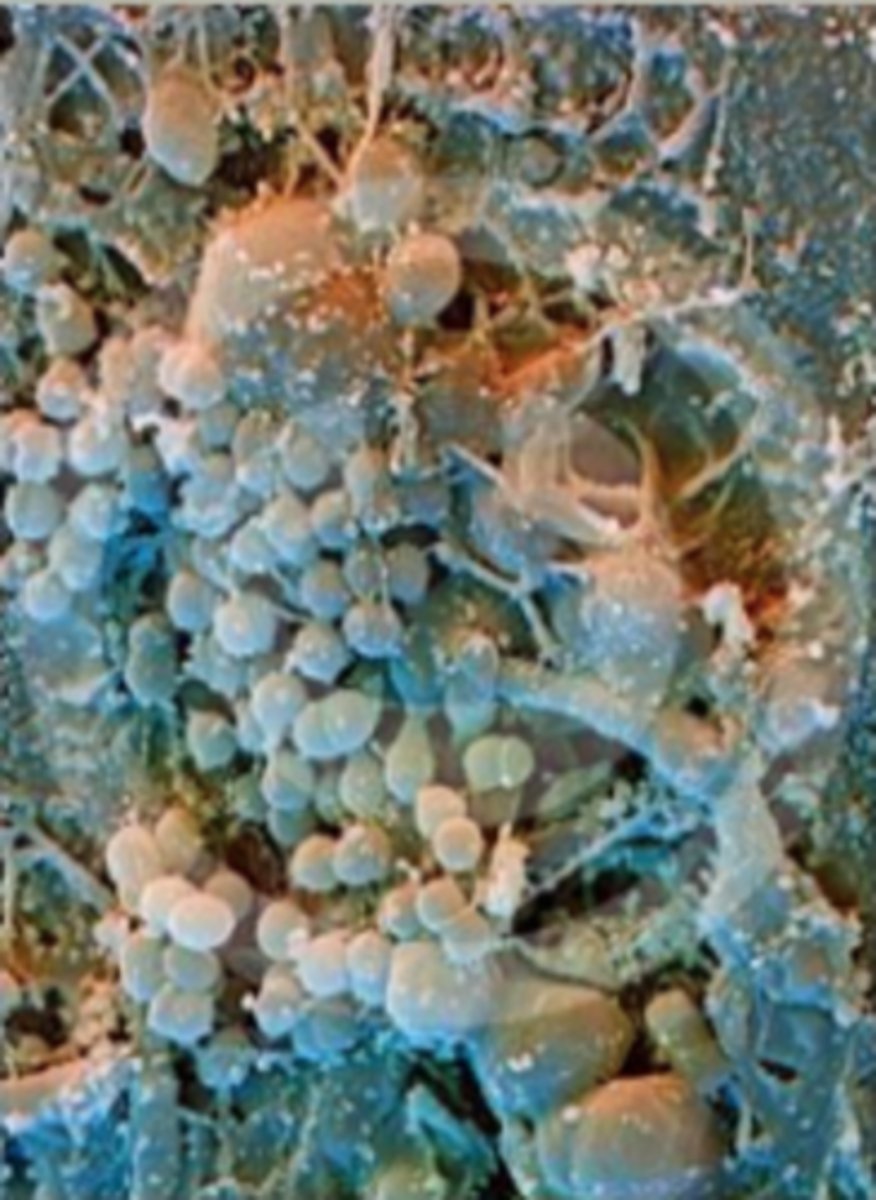 <p>False. Most cases, cultures are mixed or have multiple types of microbes.</p>