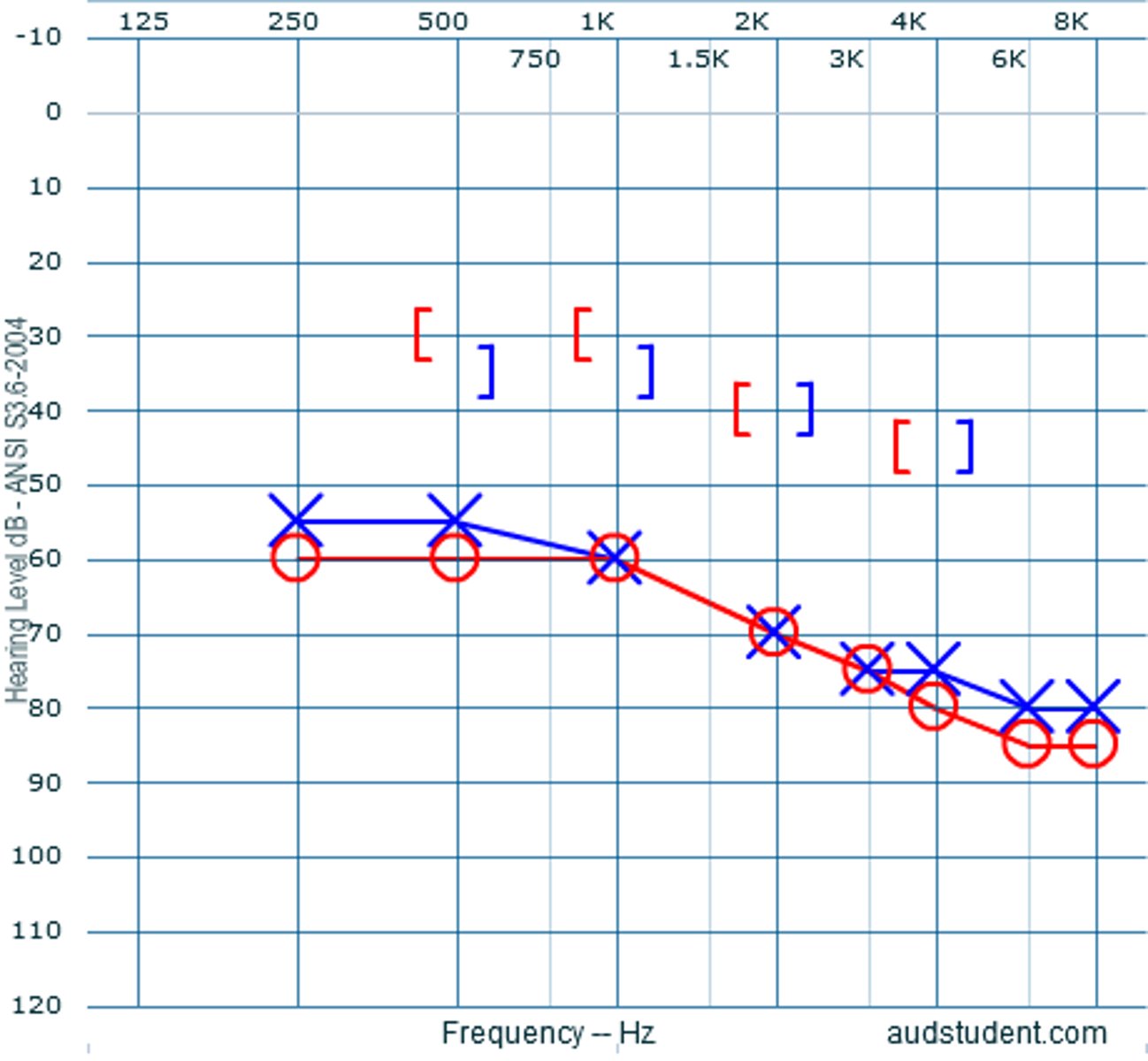 <p>mixed HL</p><p>3 multiple choice options</p>