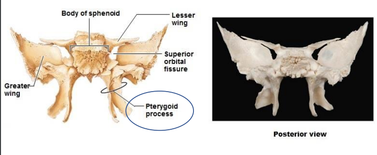 <ul><li><p>Greater wing</p></li><li><p>Lesser wing</p></li><li><p>Body of sphenoid</p></li><li><p>Superior orbital fissure</p></li><li><p>Pterygoid process</p></li></ul>