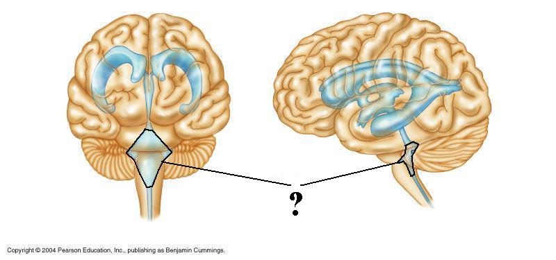 <p><span><span>Identify the indicated space</span></span></p>