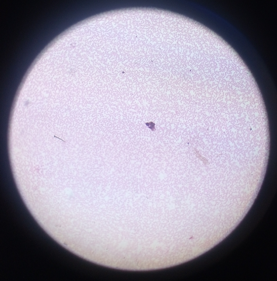 <p>Its name comes from Ancient Greek plásma meaning “something molded” and the suffix -ōdēs meaning “like” or “resembling,” referring to its amorphous, shape-shifting form during its life cycle stages. This etymology reflects the parasite’s ability to adapt morphologically as it transitions between mosquito and vertebrate hosts.</p>