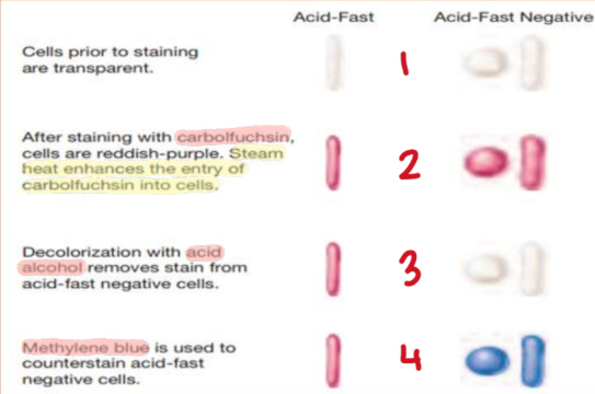 <p>“Hot method” </p><ol><li><p>Primary stain w/ Carbol Fuchsin</p></li><li><p>Heat until boiling</p></li><li><p>Cool down for 5 mins</p></li><li><p>Wash off excess w/ water</p></li><li><p>Decolorize w/ acid alcohol (HCL) for 30 secs</p></li><li><p>Counterstain w/ Methylene Blue or Malachite Green for 30 secs</p></li><li><p>Wash off excess w/ water</p></li></ol><p></p>
