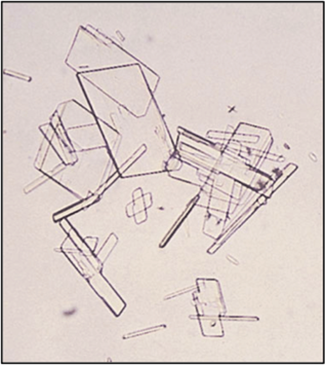 <p>Abnormal, found in nephrotic syndrome, lipiduria<br>Flat plates with notched corners</p>