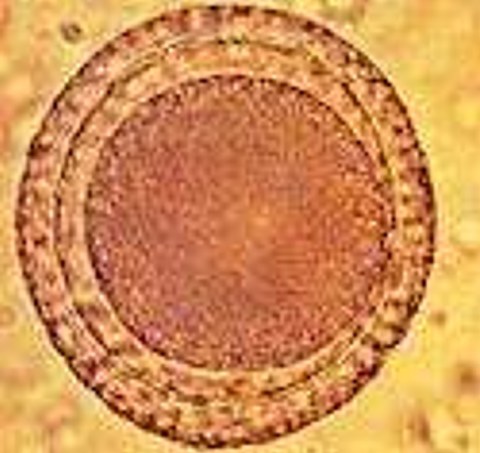 <ol><li><p>SN</p></li><li><p>LS</p></li><li><p>DH</p></li><li><p>Membrane description</p></li></ol><p></p>