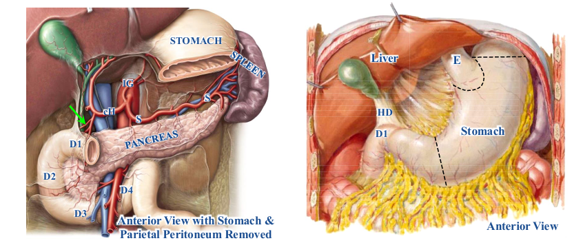 <p>-supplied by supraduodenal artery (green arrow) that can be a branch of either the hepatic or gastroduodenal arteries that go through the hepatoduodenal ligament</p>