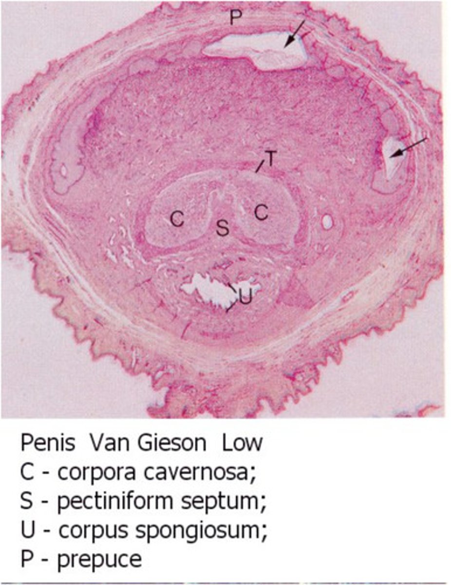 <p>corpus cavernosum</p><p>corpus spongiosum</p><p>prepuce</p><p>urethra</p>
