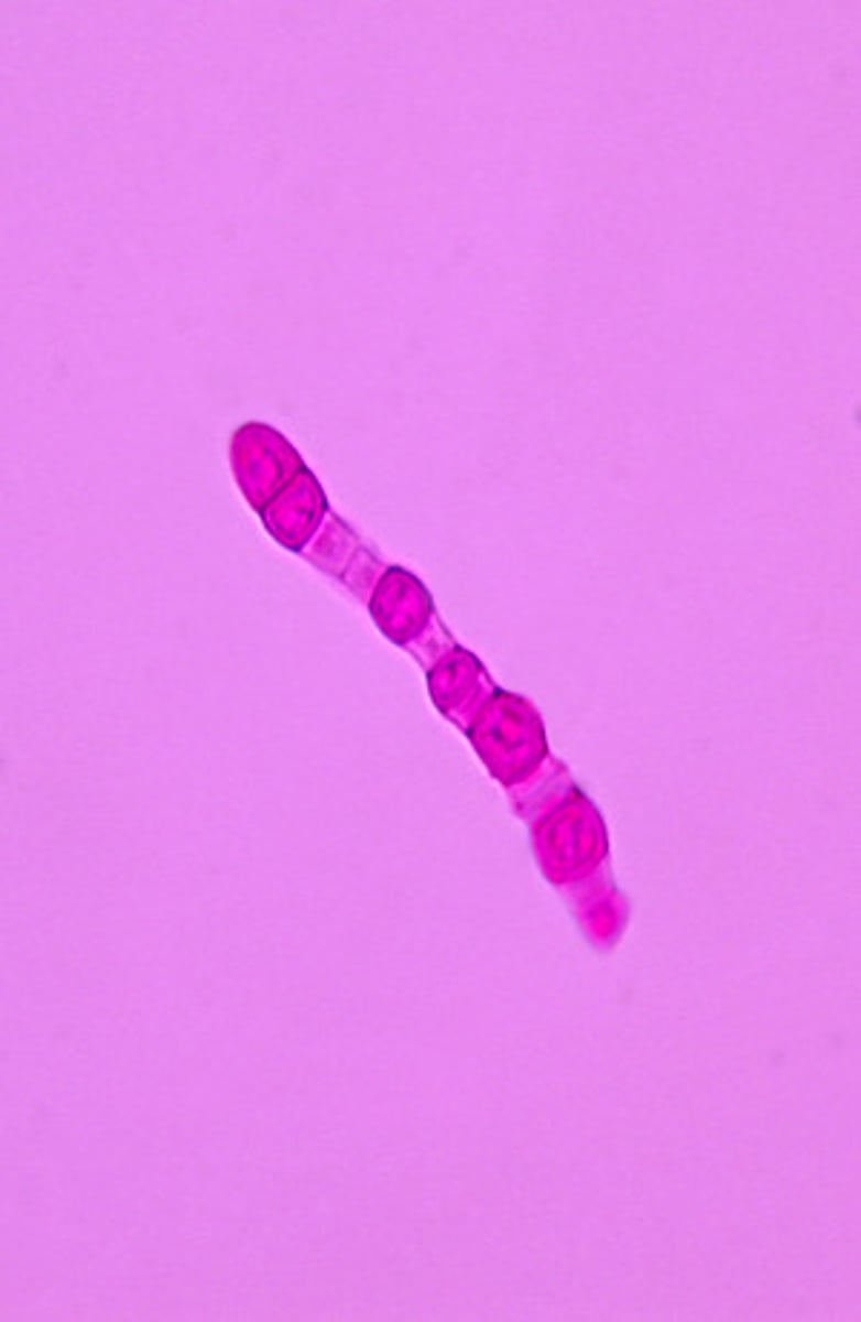 <p>In the environment or when cultured on laboratory media, Coccidioides immitis grows as a mold. In this form, it produces hyphae which differentiate into arthroconidia alternating with empty disjunctor cells.</p>