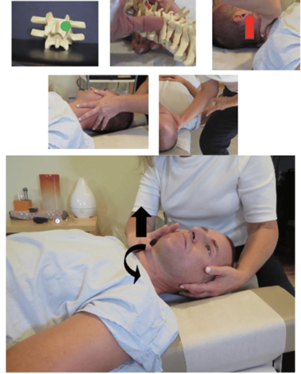 <p>• PP: Supine, asks permission to open gown/contact patient, verbalize finding the segment</p><p>• DP: Towards head of table, on side of contact, approximately 90° to patient, tissue slack M-L</p><p>• CH: Palmar surface of thumb of the hand corresponding to the side of segmental contact, on posterolateral articular pillar of superior vertebrae, palm turned down, finger rest on cheek</p><p>• IH: #1-cradles patients head, supports contralateral occiput and upper cervical spine</p><p>• VEC: P-A and slight I-S (think up and over)with counterclockwise (or clockwise rotation depending on the direction)</p>