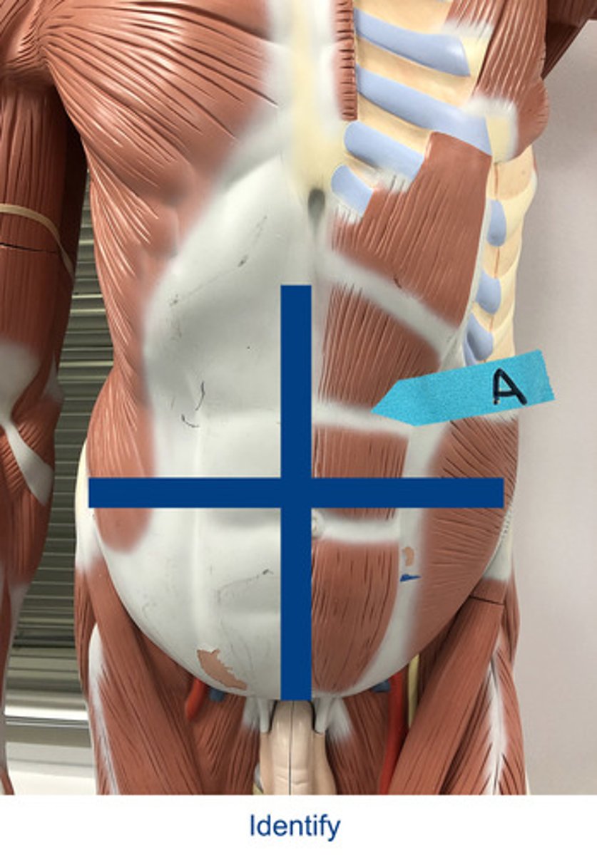 <p>Identify the area indicated by the arrow.</p>