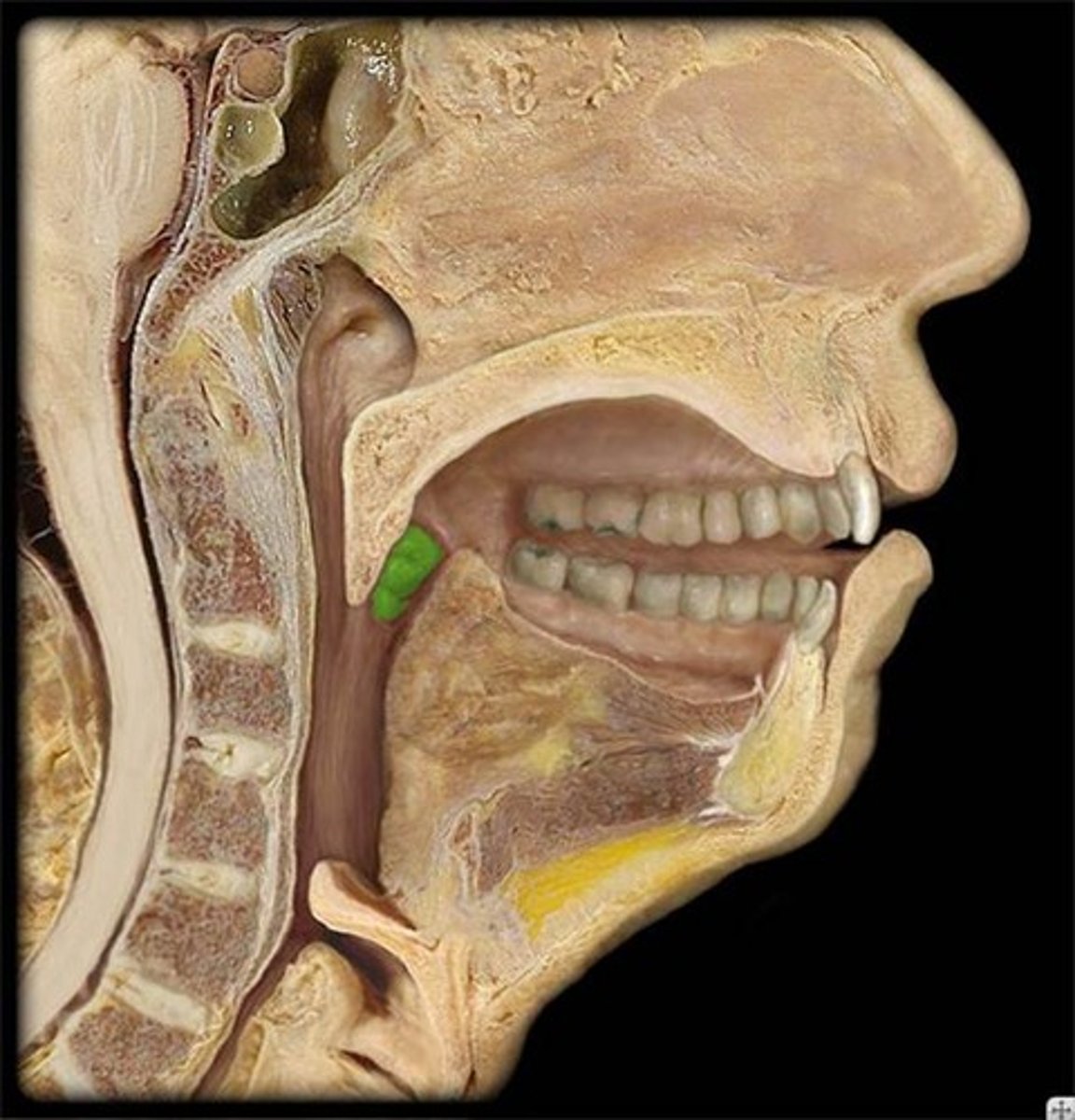 <p>Name this highlighted structure.</p>