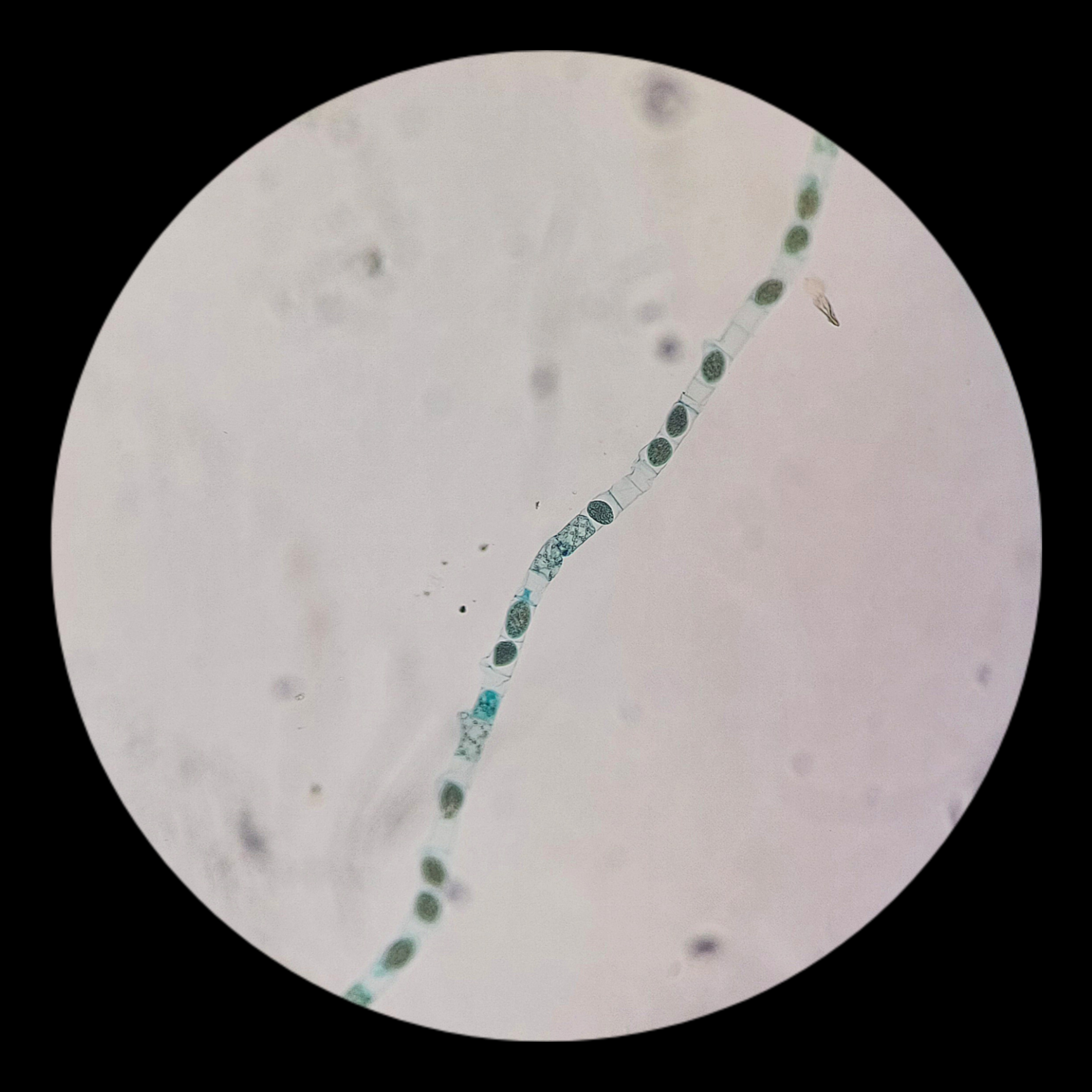 <p><strong><em>Spirogyra</em></strong></p><p><strong>Phylum: ?</strong></p>