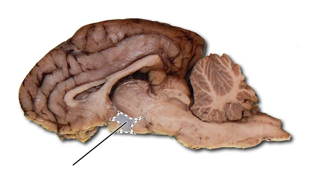 <p>Name the part of the brain that is highlighted.</p>