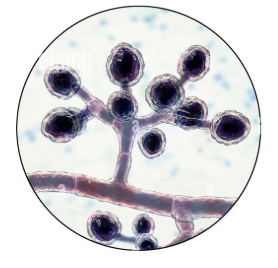 <p>what type of asexual spores is this</p>