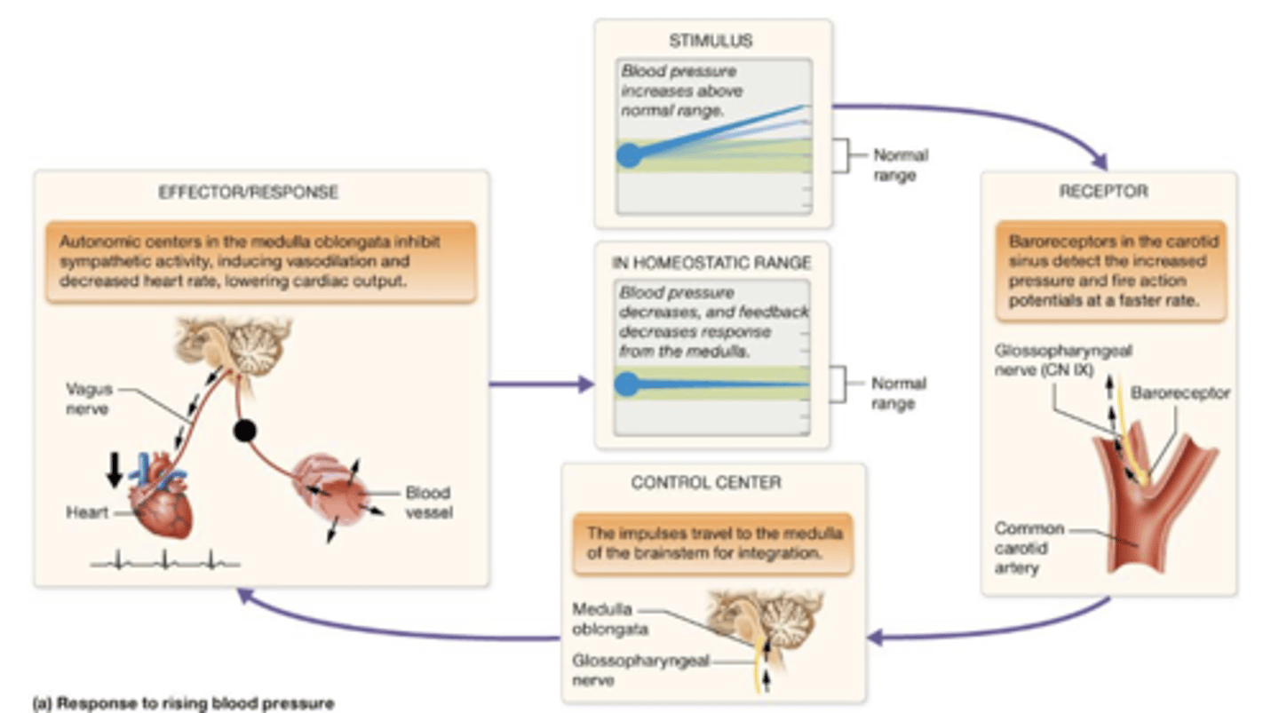 <p>1.) Baroreceptors in the carotid sinus detect increased BP and fire action potentials faster.</p><p>2.) Impulses go to medulla for integration for autonomic centers to INHIBIT sympathetic activity like vasodilation, decreased HR, lowering cardiac output</p><p>3.) blood pressure decreases, feedback decreases from medulla</p>