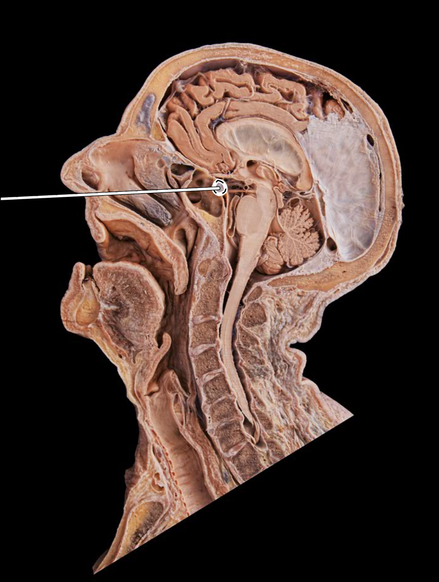 <p>What is this?</p>