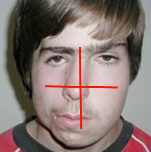 <p>Is this face a normal finding? why or why not?</p>