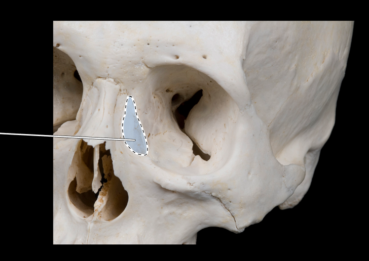 <p>Name this bone.</p><p>(Bones that form the orbit).</p>