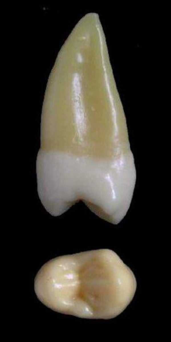 <p>what tooth is this &amp; why?</p>