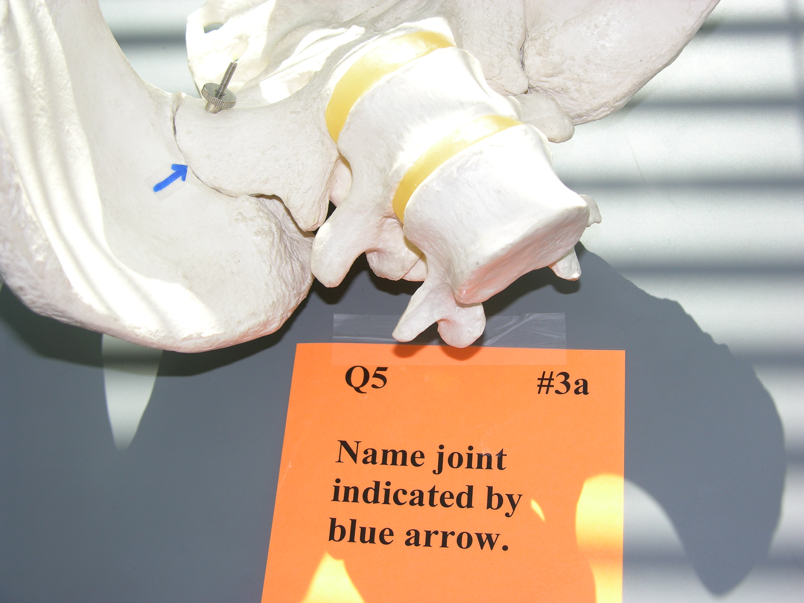 <p><span style="font-family: Lato Extended, Lato, Helvetica Neue, Helvetica, Arial, sans-serif; color: rgb(45, 59, 69)">Name the joint indicated by the blue arrow.</span></p>